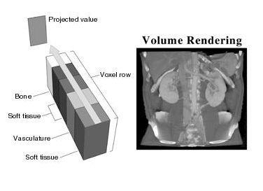 What is represented in a CT-Image HU 3000 bones 60 40 spleen pancreas kidney