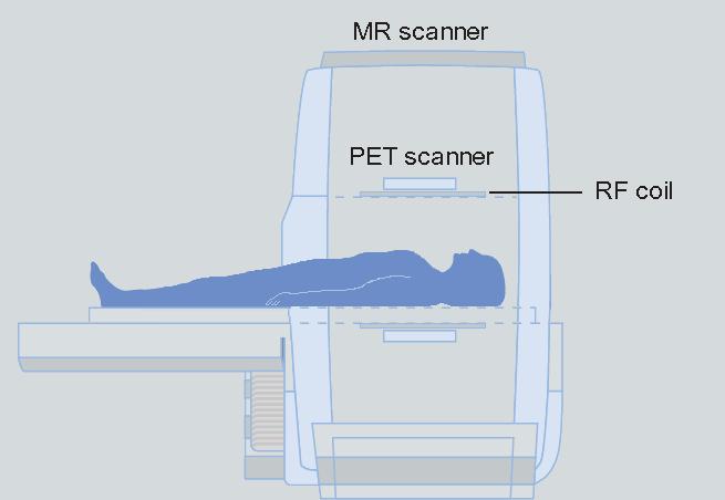 System Design Integriertes Design Integrierter Ganzkörper PET-MR für simultane Bildgebung + zeitliche Korrelation von PET