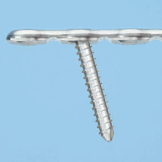9 mm Alle Schraubendurchmesser geeignet für alle Platten** Schraubeneinbringung mit bis zu 15 Versatz möglich (Achse Schraube/Schraubenzieherklinge) Je nach Plattengrösse Schraubenabwinkelung