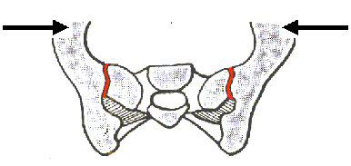 Das sacroiliacale Gelenk 11 1. Therapiepfeiler = Gurtunterstützung: Die Kraftübertragung in den sacroiliacalen Gelenken erfolgt durch eine Mischung aus Formverschluss und Kraftverschluss.
