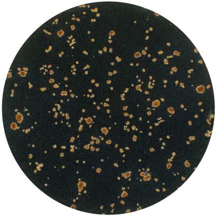 inkubieren Sie Ihre Probe 4 Zählen Sie die Kolonien Von der bis zur Auswertung OHNE Filter MIT Filter 1 3 4 Kolonien oder Bruchstücke? Kolonien 2 Kolonien oder Bruchstücke?
