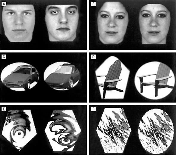 Funktionelles MRT (I) unterschiedlich gleich Gesichter Objekte