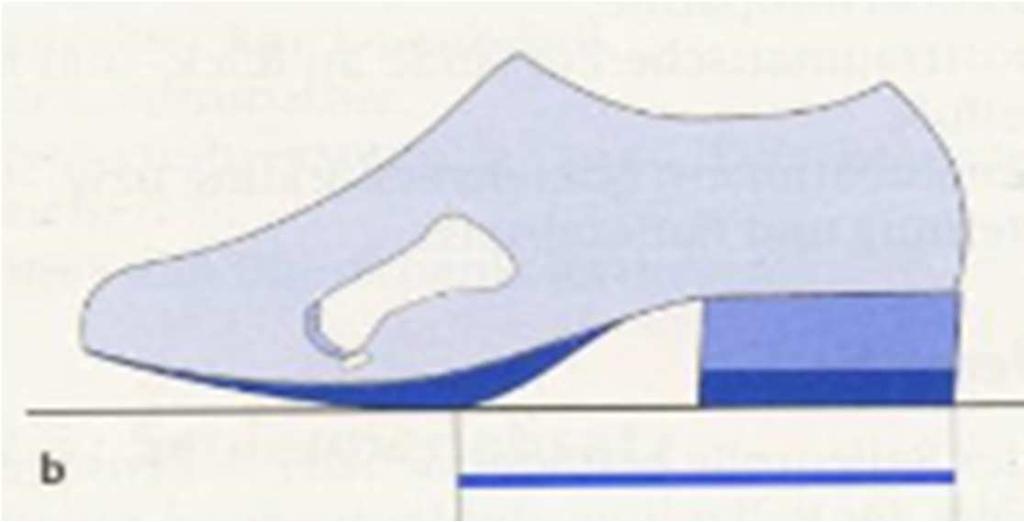 Der Fuß benötigt bei der Schrittabwicklung somit weniger Dorsalextension im MPT 1, wodurch die mechanische Belastung spürbar reduziert wird.