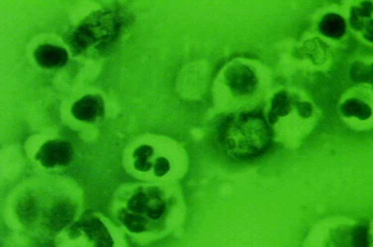 Somatische Zellen in Rohmilch