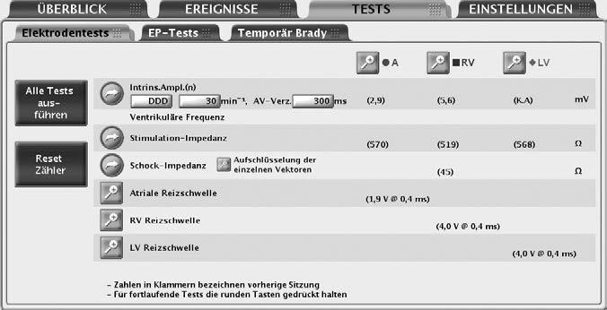 5-12 Systemdiagnostik Elektrodentests Unter folgenden Bedingungen wird nicht versucht, Intrinsische Amplitude und die Elektroden- Impedanz zu messen.