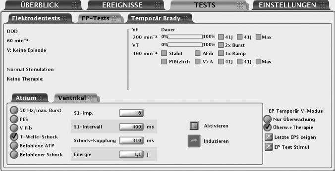 7-2 Elektrophysiologische Tests EP-Test-Funktionen EP-TEST-FUNKTIONEN Die elektrophysiologischen (EP-) Testfunktionen ermöglichen es Ihnen, Arrhythmien nicht-invasiv zu induzieren und zu terminieren,