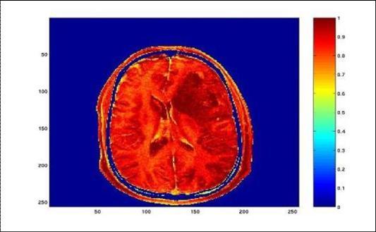 Frage: Welche physikalischen Eigenschaften sind für MRT-Bilder benutzt?