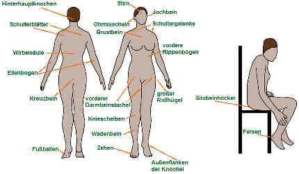 Wo kann ein Dekubitus auftreten? Wie kann ein Dekubitus vermieden werden? Das wichtigste Mittel ist, eine Bettlägerigkeit zu verhindern.