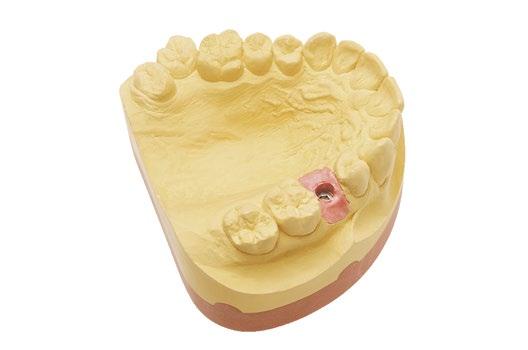 Majesthetik -Line Zahnfleischmaske speziell für die Anwendung in der CAD /