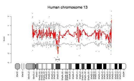 11q22-23 befindet, keine verminderte, sondern im Gegenteil eine signifikant gesteigerte Expression. Abbildung 2: Darstellung der lokalen Genexpression auf den Chromosomen 13 und 11.