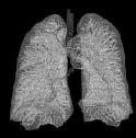 Oxygenator Unterschied Lunge Oxygenator