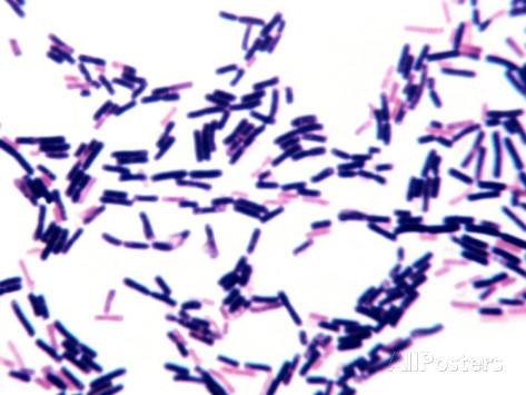 Mikrobiologie: unkomplizierter HWI Am häufigsten gramnegative Erreger Escherichia coli (ambulant 80-90%, nosokomial 30-50%) Enterobacteriacea
