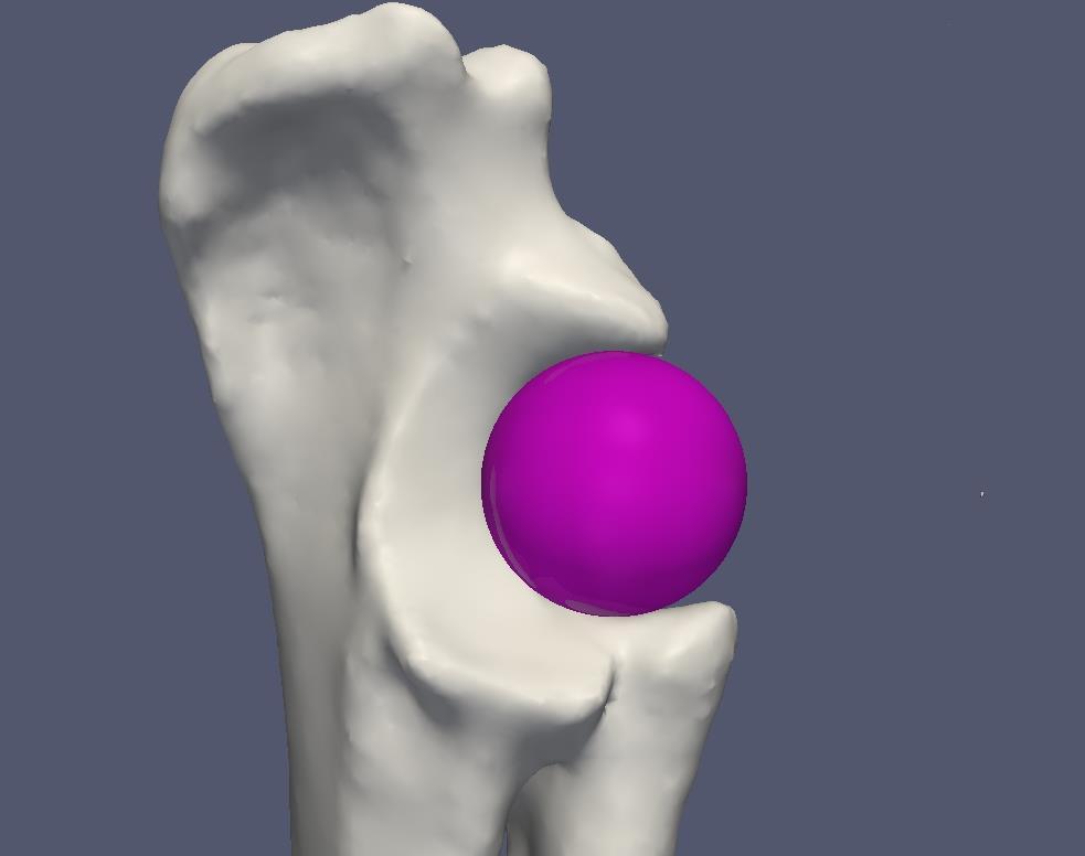 Fig 1a: 3D models of the radio-ulnar joint cup in combination with a sphere fitted to the trochlear notch of three different dogs.
