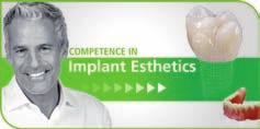 Competence in Composites Competence in All-Ceramics Competence in Implant Esthetics Diese Produkte sind aus unserem Kompetenzbereich Implant Esthetics.