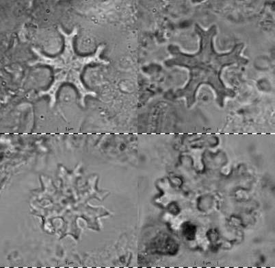 Text-Fig. 15b. Syntypes of Discoaster gemmifer in normal light at different focus levels. possess small knobs. Closely related to Discoaster deflandrei, D. distinctus and D.