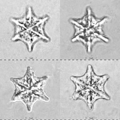 Text-Fig. 45a. Original drawings of Nannotetraster fulgens. Text-Fig. 44b. Holotype of Polycladolithus stellaris in normal light at different focus levels.