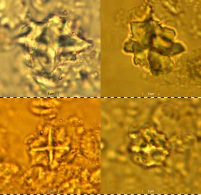 Nannotetrina spinosa (Stradner) Bukry 1973 (= Nannotetraster spinosus Stradner, 1960 in Martini & Stradner, 1960, p. 269, Text-Figs.