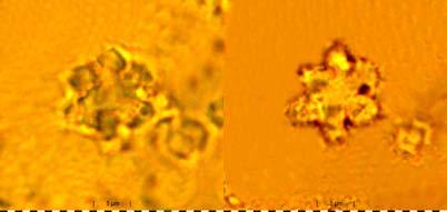 Text-Fig. 52a. Original drawings of Marthasterites bramlettei. Locus typicus: Alkazar-Formation, BR-Stat. 538, Kuba. Stratum typicum: Unter-Eozän (Tr. velascoensis-zone).