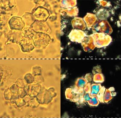 4 6 μm. Im polarisierten Lichte verhalten sie sich ähnlich wie die Porolithen von Thoracosphaera heimi Kamptner. Derivation of name: combination of favus (Lat.) = honeycomb, lithos (Gr.) = stone.