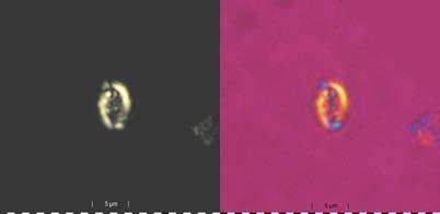 Level: Variabilis Zone, lower Jurassic ( Lias Zeta ). Size: 5 8 μm. Description: Broad-elliptical placoliths with a vaulted, radially striated distal plate and a somewhat smaller proximal plate.