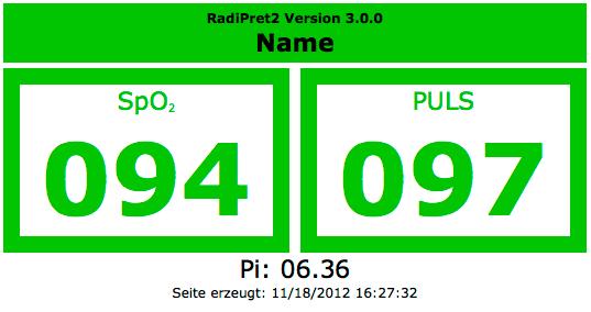 Entfernte Anzeige im Browser (Webseite) Die von RadiPret2 erzeugte Webseite zeigt die Daten für die Sauerstoffsättigung und Puls. Ein weiteres wichtiges Merkmal der Webseite ist das Erstellungsdatum.