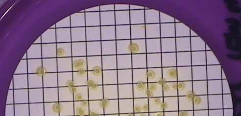 mcp-agar Reaktion Farbumschlag Saccharose Säure Bromkresolpurpur: purpur gelb bei ph 5,2