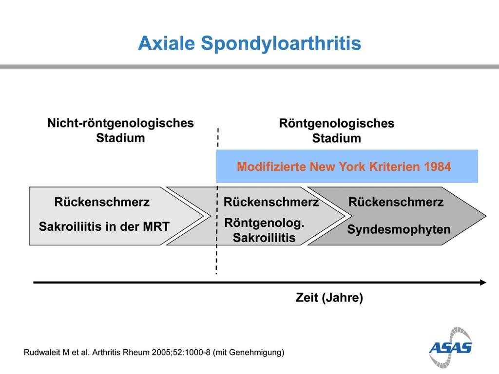 Abbildung 1: Verlauf der axialen Spondyloarthritis (Publikation mit Genehmigung durch ASAS, www.asas-group.