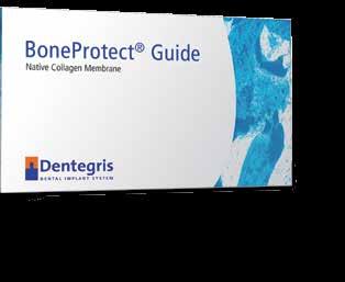 REM: BoneProtect Guide - Mittelfristige Barrierefunktion von ungefähr 8 bis 12 Wochen - Natürliche Struktur und Standarddicke von 0,4 bis 0,6mm - Kontrollierte Wundheilung mit Unterstützung der