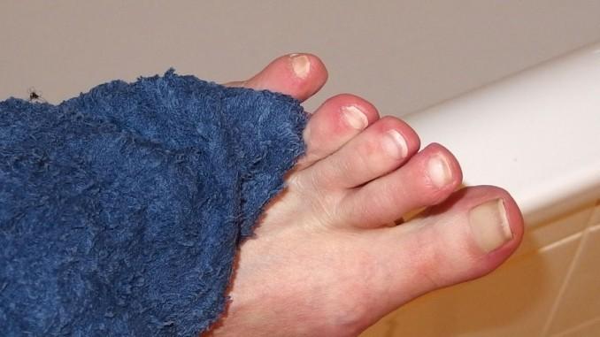 Gesundheit & Familie Fußpilz vorbeugen: regelmäßiges Reinigen der Füße & mehr 11.05.2012 Zu den vorhandenen Tipps möchte ich nichts sagen, besser sind wahrscheinlich die Mittel aus der Apotheke.