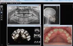 HOLEN SIE AUS JEDEM BILD DAS BESTE HERAUS LEISTUNGSSTARKE UND BENUTZERFREUNDLICHE SOFTWARETOOLS Unser benutzerfreundliches Softwarepaket wurde für die Unterstützung bei alltäglichen