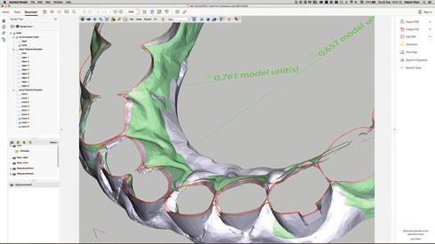 3D Behandlungsevaluation Nach Beendigung einer Behandlungsphase wird ein detaillierter 3D-Evaluationsbericht erstellt und an den