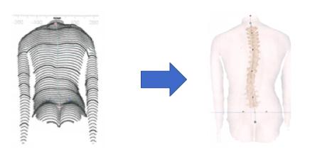 Die gesamte rekonstruierte Rückenoberfläche wird stückweise in eine Krümmungskarte von konkaven, konvexen und sattelförmigen Flächen eingeteilt. (Betsch, 2008, S.