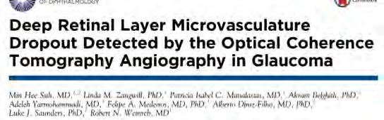 Neue Diagnostikmöglichkeiten mittels OCT Angiographie: