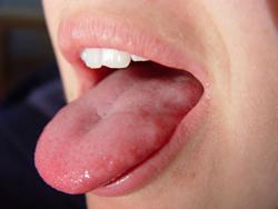 02a / Zahnprophylaxe Was ist Mundgeruch? Mundgeruch klinisch als Halitosis bezeichnet tritt in fast allen Ländern der Welt ähnlich häufig auf.