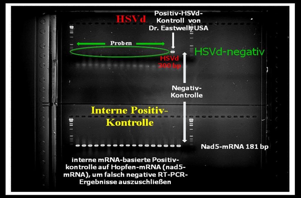 Tabelle 4.5: Ergebnisse der mit der RT-PCR-Technik auf HSVd untersuchten deutschen Hopfenproben im Frühjahr 2008 Sorte Standort Herkunft Befund Hallertauer Mfr.