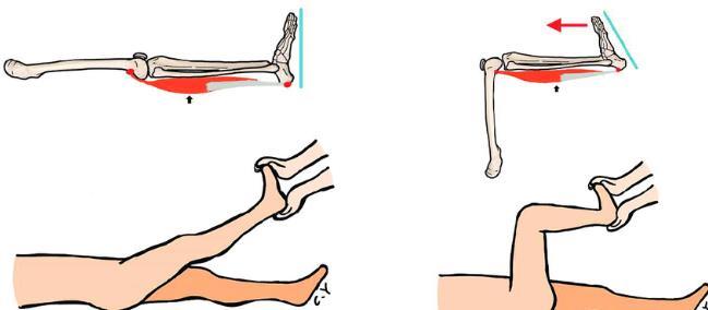 Diagnostik Sprunggelenksbeweglichkeit Dorsalextension im oberen Sprunggelenk In Knieflexion In Kniestreckung Jeweils bei fixiertem USG!