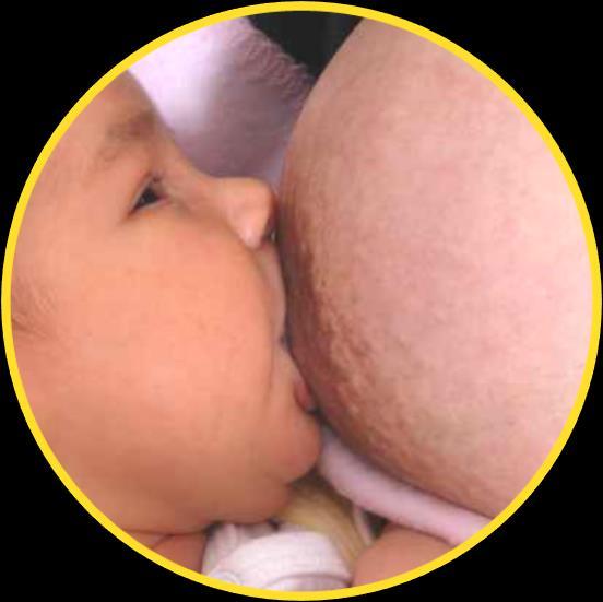 Zusammensetzung der Muttermilch passt sich an a) Mit zunehmendem Alter des Kindes nach der Geburt: Kolostrum Immunglobuline Übergangsmilch Eiweiß Fett reife Frauenmilch b)