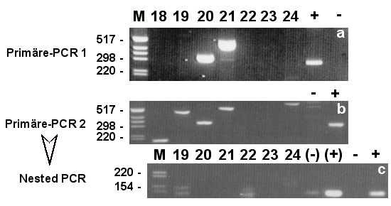 Auf jede Primäre-PCR wurden zwei Nested-PCR s durchgeführt, einmal mit dem Primerpaar 288-5'/288#12 (a und c) und einmal mit dem Primerpaar 288#13/288#12 (b und d).