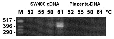 82 Ergebnisse NT_005616.25 cdna. Es wurde mit verschiedenen Primerkombinationen getestet, ob die Sequenz #288 mit der vorhergesagten cdna NT_005616.25 übereinstimmt.
