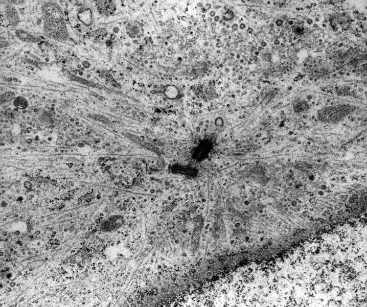 EM Bild des Cytocentrums (Centrosoms) mit den 2