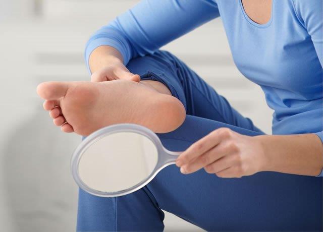 Fußkontrolle: Wichtigste Prävention des DFS Kleine Verletzungen bleiben bei Diabetes häufig unbemerkt