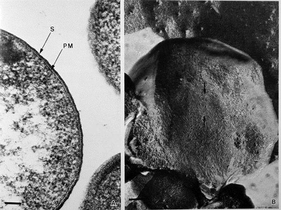 ) Bezüglich der Zellwand gibt es bei sehr unterschiedliche Typen. Einige besitzen einen Sacculus aus Pseudomurein, das ebenfalls ein Glycopeptid ist.