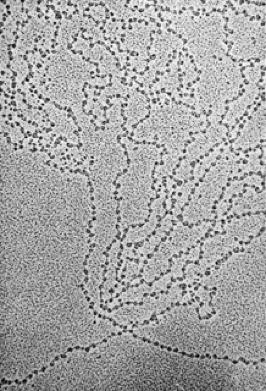 Die einzelnen Nukleosomen sind durch kurze DNA-Abschnitte ( Linker ) verbunden, das sieht im EM wie Perlen an einer Kette aus. Der DNA/ Protein-Komplex heißt Chromatin.