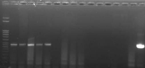 Ergebnisse M 1392 1406 1410 1413 1421 1425 2850 - + Abb. 15: JDP-PCR mit den 7 Acanthamoeba spp.-kulturen. M = DNA-Marker, - = Negativkontrolle, + = Positivkontrolle (A+).