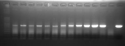 Ergebnisse 3.5 Filterstanzen Acanthamoeba 3.5.1 JDP-PCR Die Sensitivität der JDP-PCR wurde zunächst mit den Akanthamöben-Stämmen 1BU und 4Cl ausgetestet.