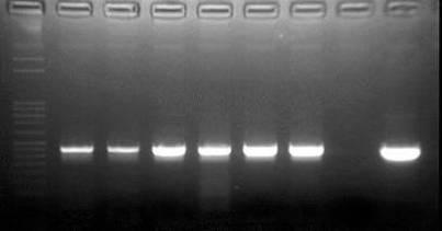 Ergebnisse M 10³ 10 4 10 5 - + Abb. 22: Test-JDP-PCR mit der DNA einer filtrierten Verdünnungsreihe von Zellen des 1BU-Stammes. M = DNA- Marker, - = Negativkontrolle, + = Positivkontrolle (A+).