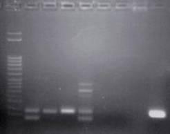 Ergebnisse Tab. 9: Testen der Nested-PCR. M 1412 1413 -nest - + PCR-Test 1. PCR JDP1/P3rev 2. PCR P2fw/JDP2 1. 52 C 52 C 2. 52 C 54 C 3. 54 C 54 C 4. 54 C 56 C 5. 52 C 56 C optimales Ergebnis Abb.
