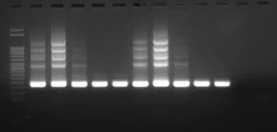 Ergebnisse 1BU 4Cl M unverdünnt 10-1 10-2 10-3 unverdünnt 10-1 10-2 10-3 - -nest Abb. 25: Vergleich der Nested-PCR mit DNA-Verdünnungsreihen von 1BU und 4Cl.