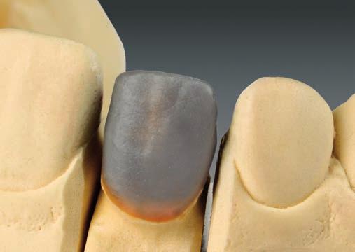 Modellation Schichttechnik: n Die Modellation der Gerüste sollte Zahnform unterstützend sein, um eine gleichmäßige Schichtstärke der Schichtkeramik zu erzielen.