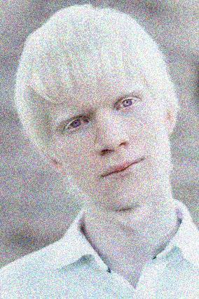 bilden. Diese Albinismusform ist alleine vom Phänotyp entscheidend und nicht vom Genotyp.